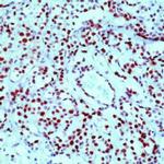 Rb Antibody in Immunohistochemistry (Paraffin) (IHC (P))