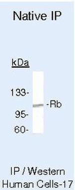 Rb Antibody in Immunoprecipitation (IP)