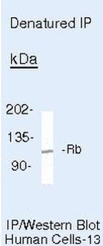 Rb Antibody in Immunoprecipitation (IP)