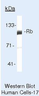 Rb Antibody in Western Blot (WB)