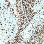 CD22 Antibody in Immunohistochemistry (IHC)