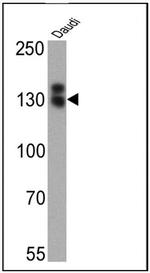 CD22 Antibody in Western Blot (WB)
