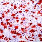 ALK Antibody in Immunohistochemistry (Paraffin) (IHC (P))