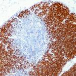 TdT Antibody in Immunohistochemistry (Paraffin) (IHC (P))