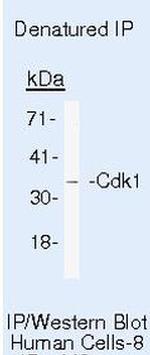 CDK1 Antibody in Immunoprecipitation (IP)