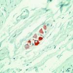 RET Antibody in Immunohistochemistry (IHC)