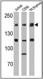 CD45RO Antibody in Western Blot (WB)