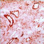 ICAM-1 Antibody in Immunohistochemistry (Frozen) (IHC (F))