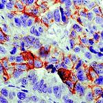 CA125 Antibody in Immunohistochemistry (Paraffin) (IHC (P))