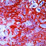 Cytokeratin 14 Antibody in Immunohistochemistry (IHC)