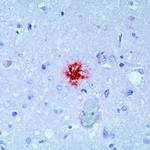 beta Amyloid Antibody in Immunohistochemistry (Paraffin) (IHC (P))