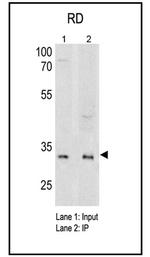Myogenin Antibody in Immunoprecipitation (IP)