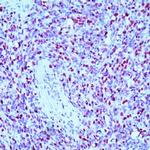 Myogenin Antibody in Immunohistochemistry (Paraffin) (IHC (P))
