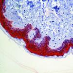 14-3-3 sigma Antibody in Immunohistochemistry (Paraffin) (IHC (P))