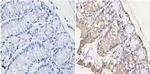 Survivin Antibody in Immunohistochemistry (Paraffin) (IHC (P))