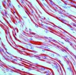 TPM1 Antibody in Immunohistochemistry (Paraffin) (IHC (P))