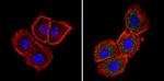 ARF6 Antibody in Immunocytochemistry (ICC/IF)