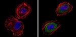 ARF6 Antibody in Immunocytochemistry (ICC/IF)