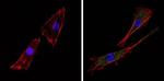 ARF6 Antibody in Immunocytochemistry (ICC/IF)