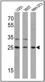 ARF6 Antibody in Western Blot (WB)