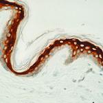 Involucrin Monoclonal Antibody (SY5)