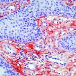 Tenascin C Antibody in Immunohistochemistry (IHC)