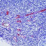 CD105 Antibody in Immunohistochemistry (IHC)