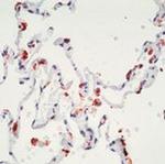 SFTPB Antibody in Immunohistochemistry (IHC)