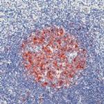 ST6GAL1 Antibody in Immunohistochemistry (Paraffin) (IHC (P))