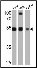 ST6GAL1 Antibody in Western Blot (WB)