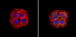 Bcl-xL Antibody in Immunocytochemistry (ICC/IF)