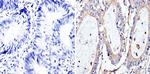 Bcl-xL Antibody in Immunohistochemistry (Paraffin) (IHC (P))