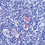 Bcl-xL Antibody in Immunohistochemistry (Paraffin) (IHC (P))