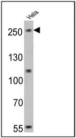 NOTCH1 Monoclonal Antibody (A6)
