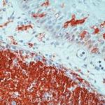 HLA-DR Antibody in Immunohistochemistry (Paraffin) (IHC (P))