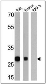 HLA-DR Antibody in Western Blot (WB)