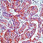 Cytokeratin 7 Antibody in Immunohistochemistry (Paraffin) (IHC (P))