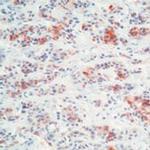 Prolactin Antibody in Immunohistochemistry (Paraffin) (IHC (P))