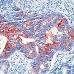ECM1 Antibody in Immunohistochemistry (IHC)