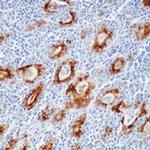 Thyroglobulin Antibody in Immunohistochemistry (IHC)