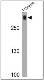 Thyroglobulin Antibody in Western Blot (WB)