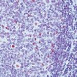 XPF Antibody in Immunohistochemistry (Paraffin) (IHC (P))