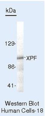 XPF Antibody in Western Blot (WB)