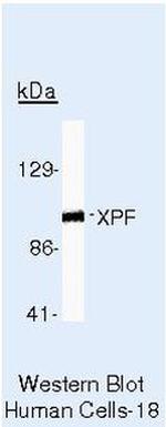XPF Antibody in Western Blot (WB)