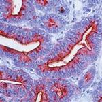 TAG72 Antibody in Immunohistochemistry (IHC)