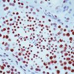 XRCC1 Antibody in Immunohistochemistry (Paraffin) (IHC (P))