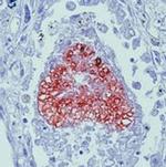 Pneumocystis jiroveci / carinii Antibody in Immunohistochemistry (IHC)