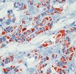 Cytokeratin 18 Antibody in Immunohistochemistry (Paraffin) (IHC (P))