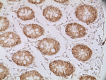 EpCAM Antibody in Immunohistochemistry (Paraffin) (IHC (P))