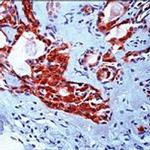 VEGF Antibody in Immunohistochemistry (Paraffin) (IHC (P))